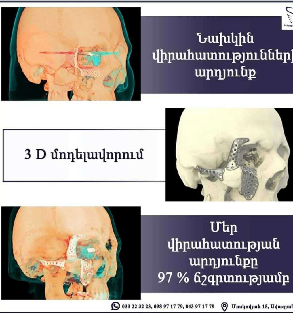Ревизионный кейс — до и после