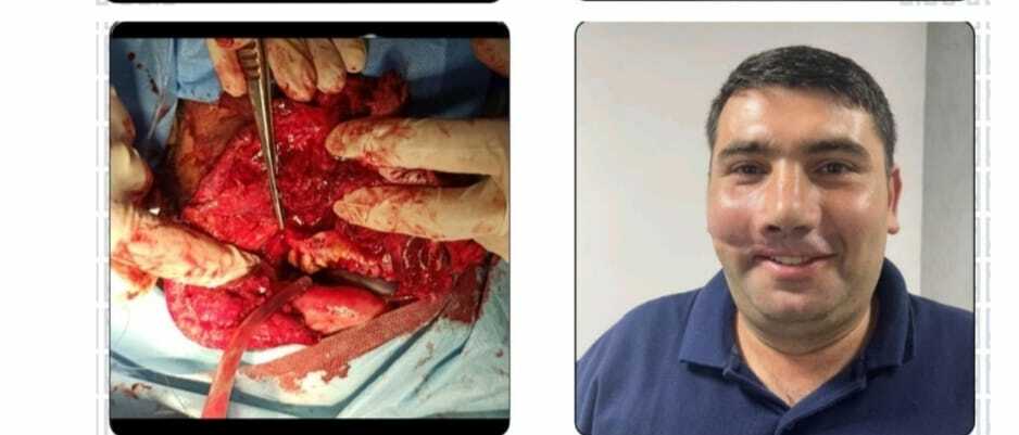 Операция и результат